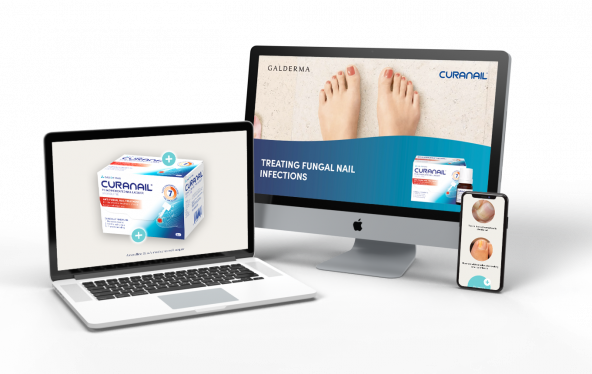 treating-fungal-nail-infections